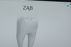 budowa_zeba